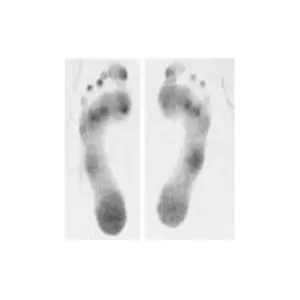 Podogramma bi podalico per rilevare l'impronta plantare